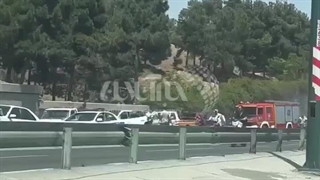 تصادف زین الدین اکستنشن تاج دندان