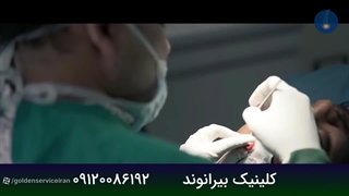 کاشت مو در مرکز کاشت مو بیرانوند در تهران