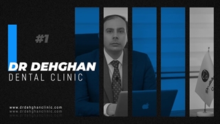 دکتر وحید دهقان : کاشت ایمپلنت و مراحل آن