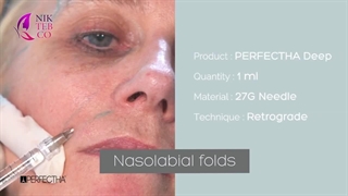 ژل پرفکتا فرانسه به خطوط اطراف لب و بینی