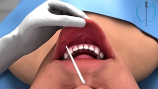 انیمیشن پزشکی سه بعدی - روش دهلیزی تیروئیدکتومی اندوسکوپیک ترانس دهانی