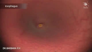 چگونه بدن شما غذا را به سیستم گوارش انسان در انسان تبدیل می کند|زیرنویس انگلیسی