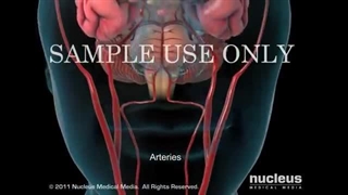 سکته مغزی | انیمیشن سه بعدی