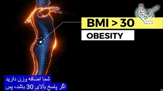 رابطه چاقی و حملات قلبی