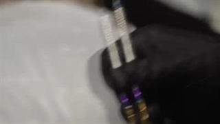 دکتر کوروش وکیلی لمینت,کامپوزیت و خدمات زیبایی