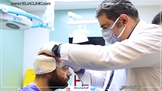 انتخاب بهترین روش کاشت موی مناسب برای شما توسط دکتر خراسانی در کلینیک هلیا