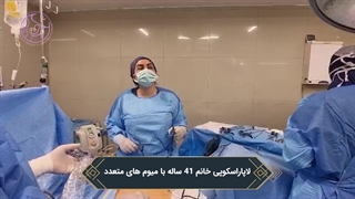لاپاراسکوپی خانم 41 ساله با میوم های متعدد