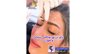 نمونه تزریق بوتاکس پیشانی و صورت