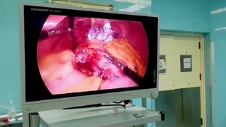 جراحی ریزه‌خواری، شیرینی‌خواری ریفلاکس شدید یا گشادی معده|دکتر محمود حیدری | چراحی چاقی