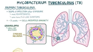 پاتولوژی پزشکی -سل یا توبرکولوز (اسموزیس)