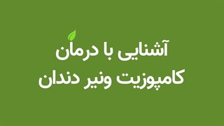 آشنایی با ونیرها و کامپوزیت ونیرها