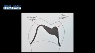 پریدگی و ترک در پرسلن قسمت دوم