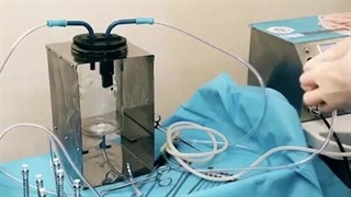 دستگاه پزشکی Lipo Modeling (پارت4)
