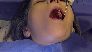 آماده سازی لثه برای ایمپلنت