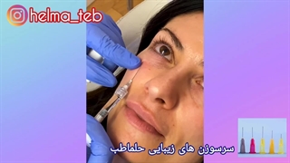 میکروکانولا