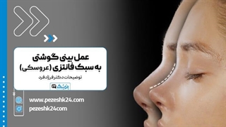 دکتر اسماعیل فرزادفرد فوق تخصص جراحی پلاستیک و زیبایی در مشهد آر اف فرکشنال