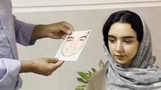 2 ماه بعد از عمل دکتر کیان احمدی