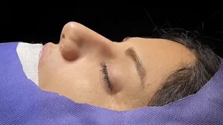 نمونه عمل جراحی بینی نیمه فانتزی