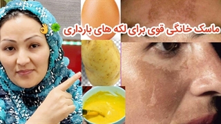 ماسک خانگی ضد لک های بارداری ترمیم زیبایی دندان