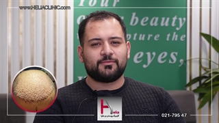نتایج کاشت مو پس از گذشت ۳ ماه در کلینیک هلیا