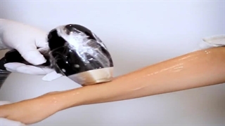 لیزر موهای زائد بدون درد!!! کاشت ابرو