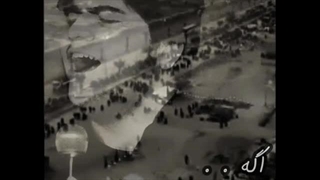 ابوالفضل قاسم پور - دعوت جراحی پف زیر چشم