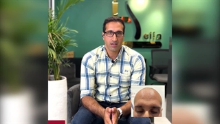 اعتماد به نفس از نو با کاشت مو در کلینیک هلیا