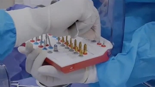 انجام ایمپلنت مشهد در کلینیک دندانپزشکی بارانا