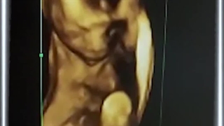 تاب بازی جنین در شکم مادر