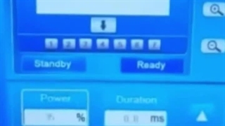 آشنایی با دستگاه لیزر فرکشنالco2