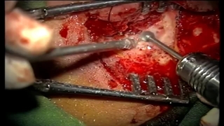 توده تمپورال