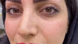 مرکز تخصصی ابرو چشم لب