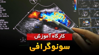 کاربردهای سونوگرافی در تشخیص بیماری ها