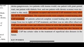 درمان زخم با دستگاه پزشکی Plasma Surgical