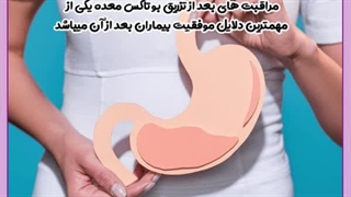 مراقبت های بعد از بوتاکس معده کلینیک زیبایی