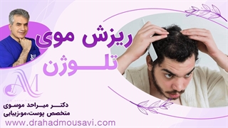 می‌دونی ریزش موی تلوژن چیه و چه جوری درمان میشه