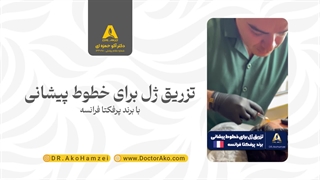 تزریق ژل برای خطوط پیشانی با برند پرفکتا فرانسه توسط دکتر آکو حمزه ای لیزر مو
