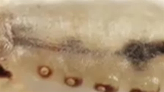 اثرات احتمالی امواج فراصوت بر بافت‌های بدن انسان