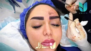 آموزش قیچی کردن ابروی کاشت شده