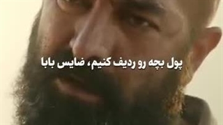 سیاوش جراحی پف زیر چشم
