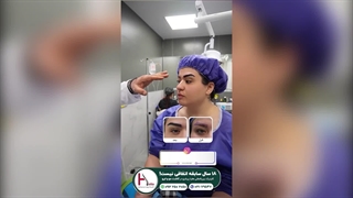 کاشت ابرو ظریف و پرتراکم - روشی که زندگی شما را تغییر می‌دهد