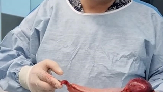 پیکرتراشی، لیپوساکشن و بلفاروپلاستی: راهی به سوی زیبایی و اعتماد به نفس