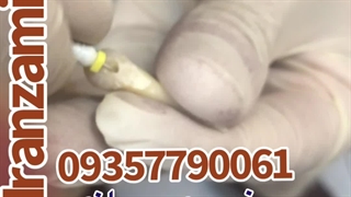 آموزش عصبکشی دندان حضوری مجازی ایران زمین