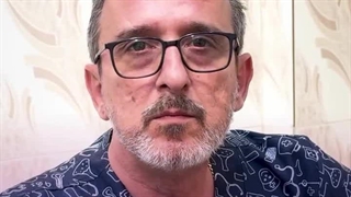 دکتر حمید ارونقی ماموپلاستی