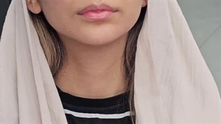 دکتر مسعود حیدری کاشت مو