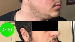 دکتر مجتبی امیری جوانسازی پوست