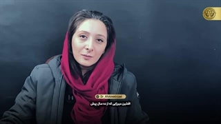 تجربه درمان ایمپلنت دندان | دکتر افشین میرزایی رفع غبغب