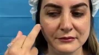 دکتر حمیدرضا فتحی جراحی گوش