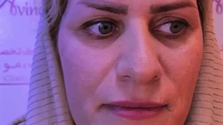 کاشت ابرو در کلینیک آوینا